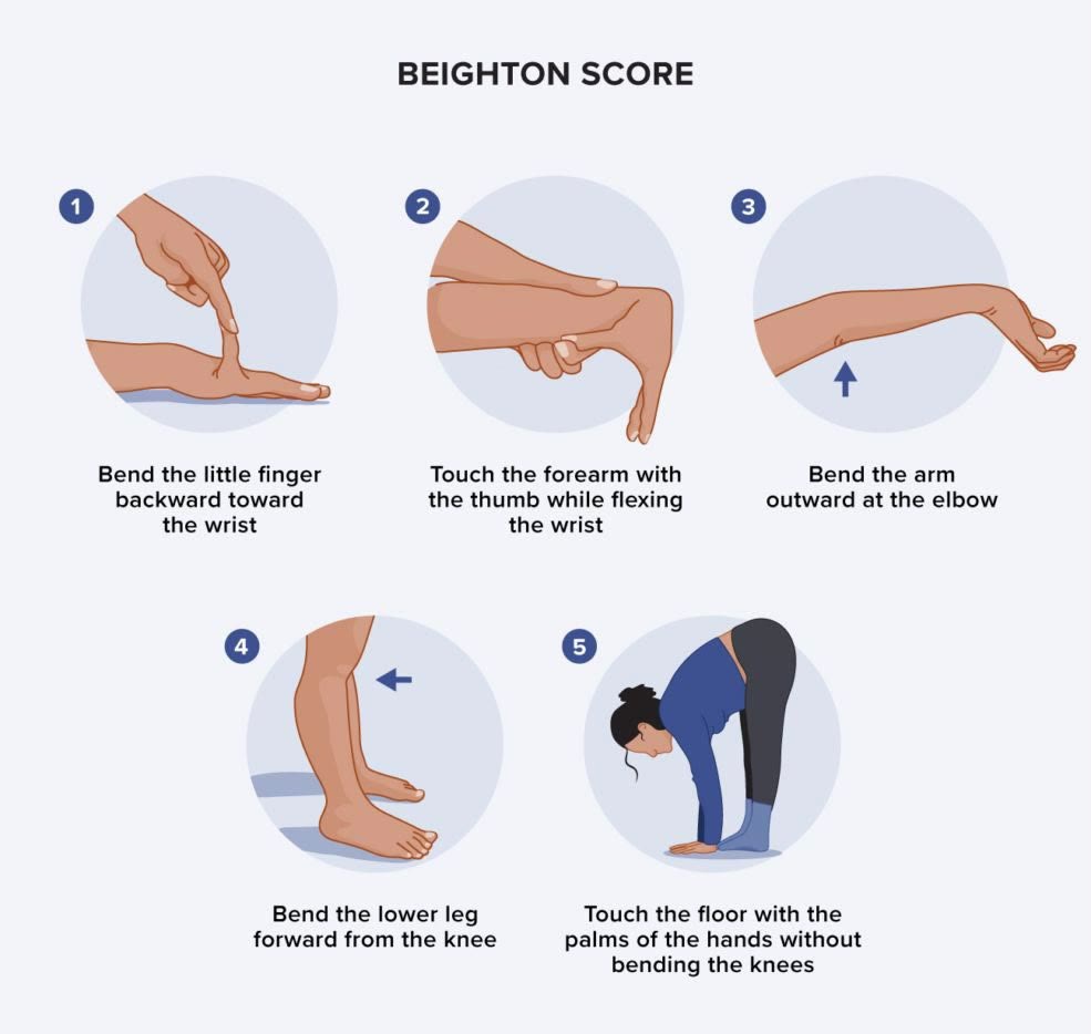The five Beighton score tests: little finger, thumb, elbow, knee and forward bend